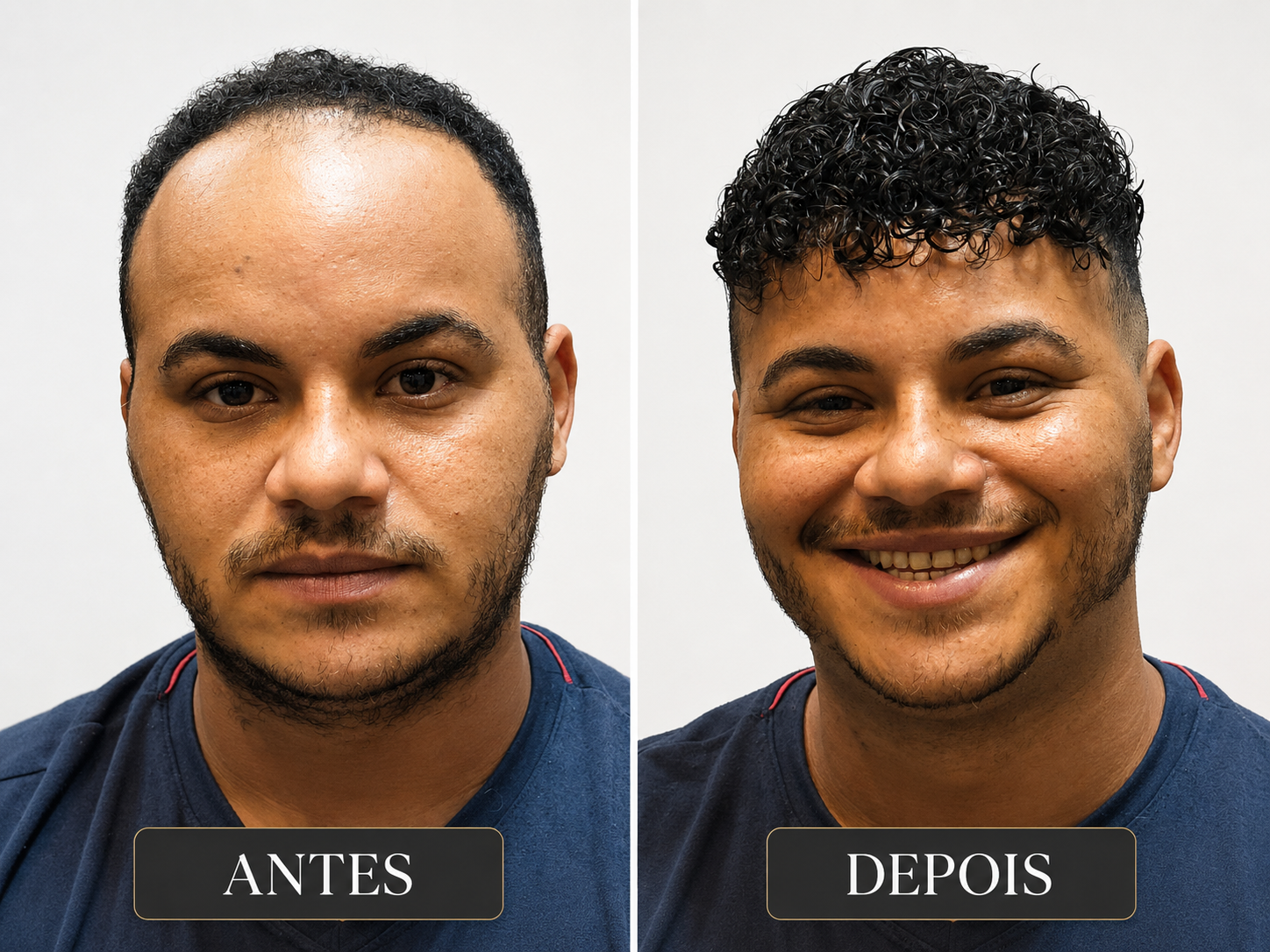 Antes / Depois 1