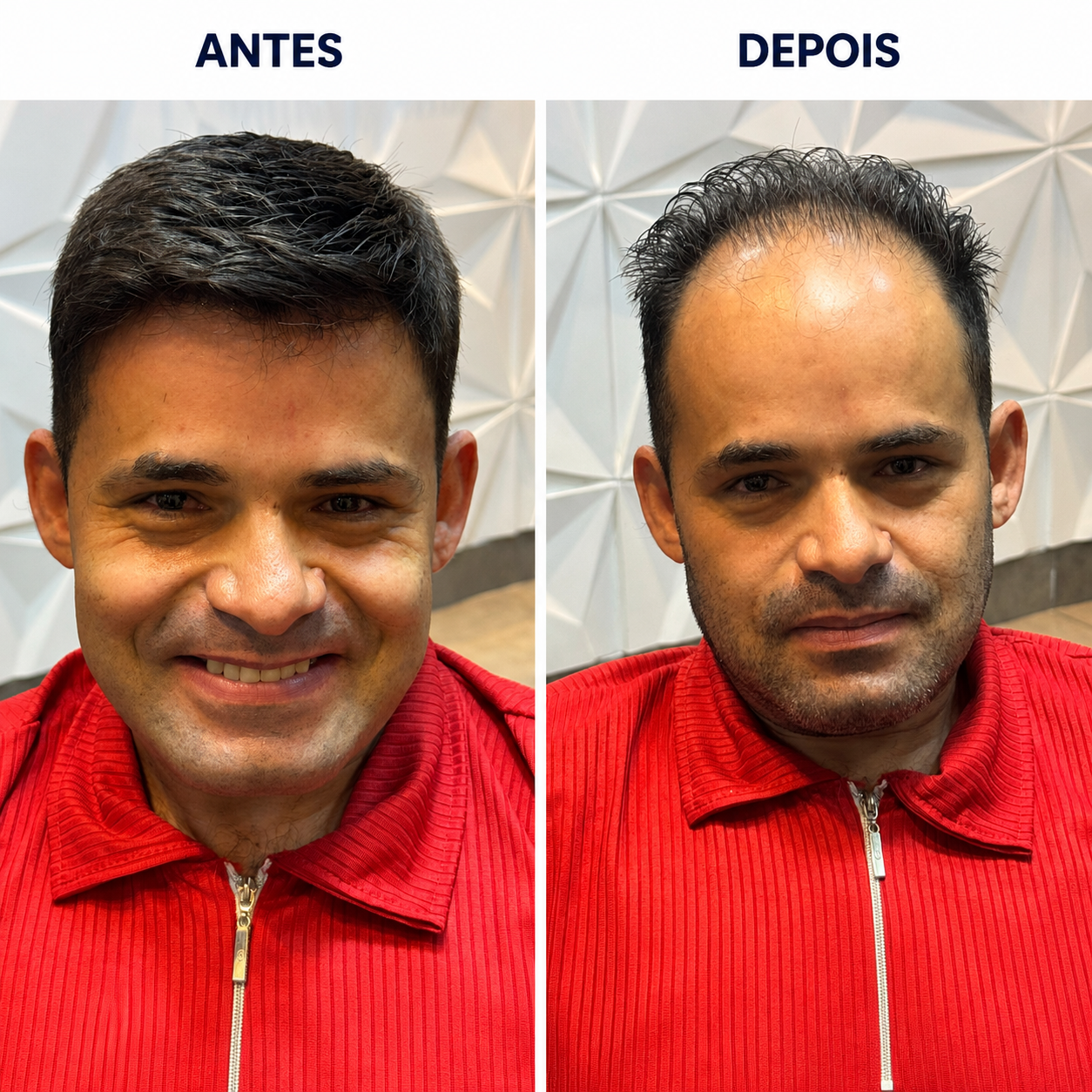 Antes / Depois 3